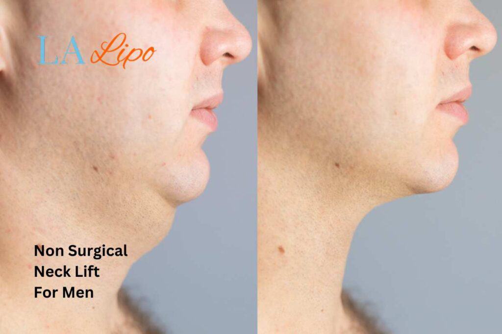 neck