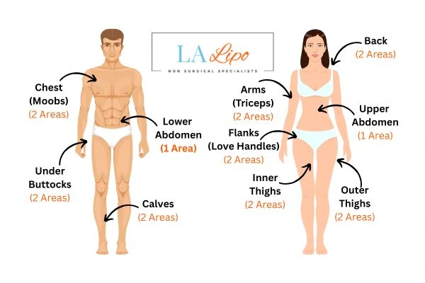LA LIPO Cryolipolysis Areas Croydon